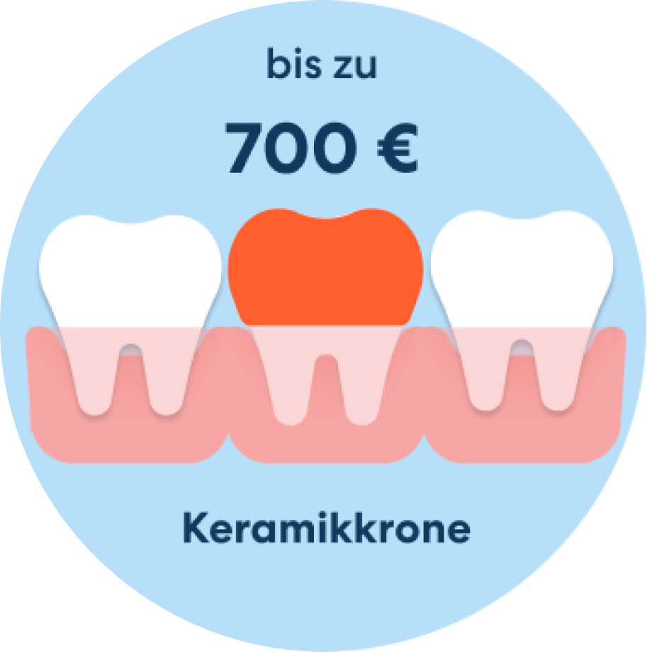 Kosten Krone Zahnzusatzversicherung