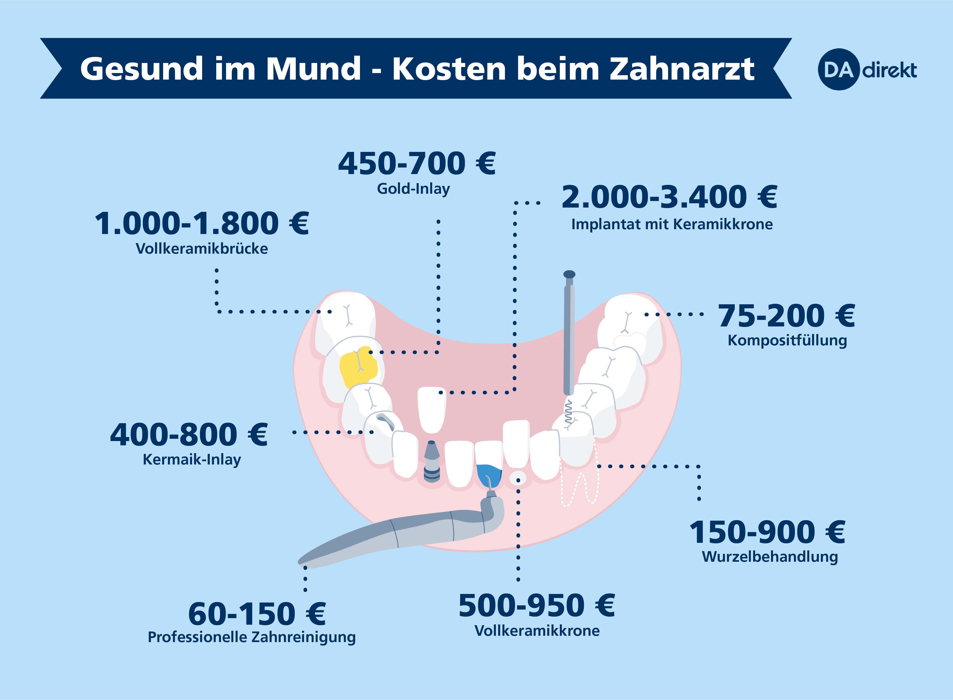 Gesund im Mund - Übersicht der Kosten beim Zahnarzt von DA Direkt.