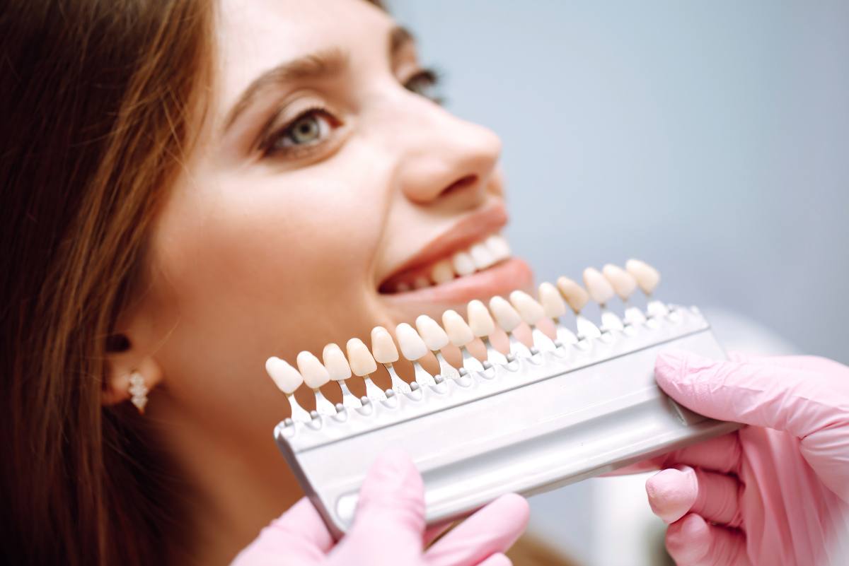 Bleaching in der Zahnarztpraxis ist am effektivsten und schadet den Zähnen am wenigsten.