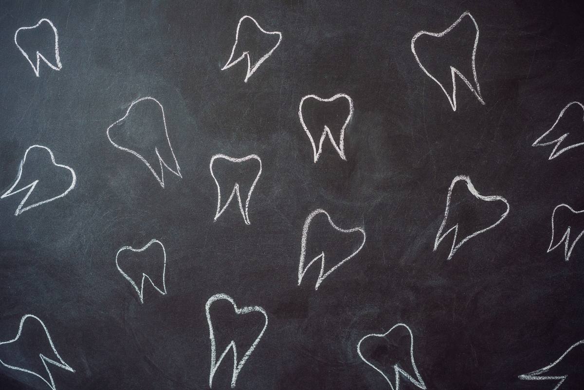 Kreidezähne sind weißlich bis braunverfärbt und schmerzen.
