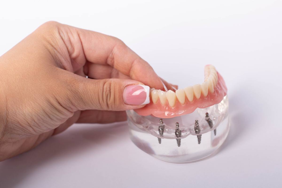 Zahnprothese Kosten