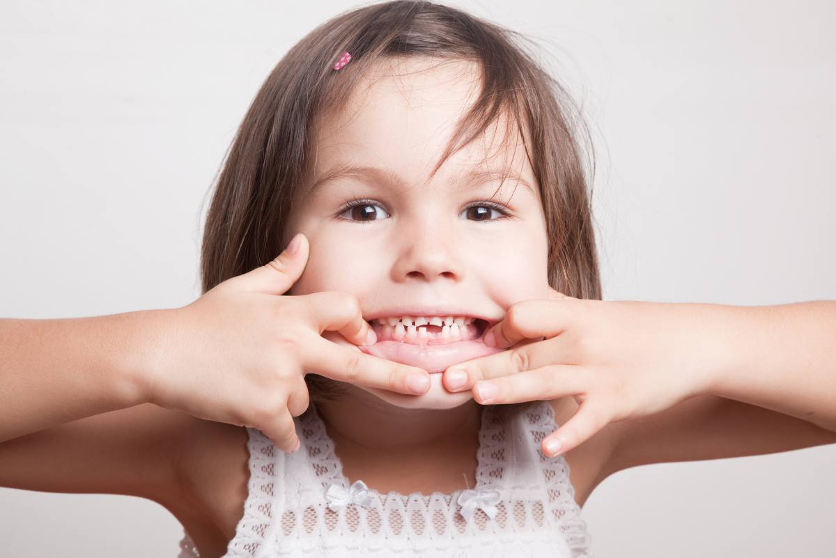 Der Zahnwechsel beginnt bei den meisten Kindern im Vorschulalter