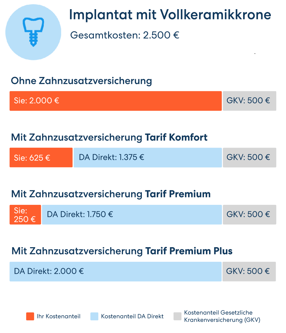 Vergleichsgrafik für die Übernahme der Kosten für ein Implantat mit Vollkeramikkrone. Von 2000 € Eigenbeteiligung ohne Zusatzversicherung bis zur vollen Kostenübernahme im Premium Plus Tarif