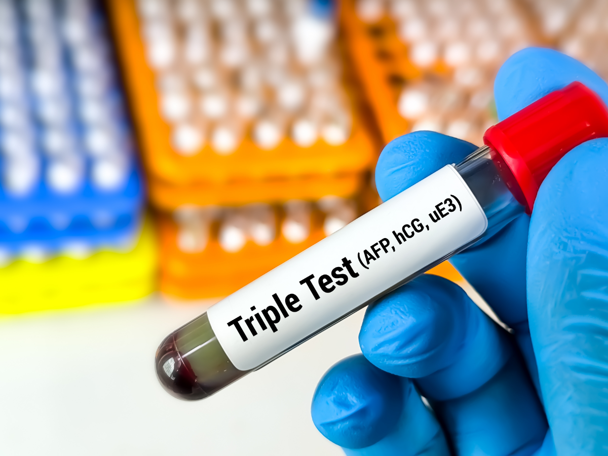 Der Triple-Test kann auf für genetische Defekte beim Ungeborenen hinweisen