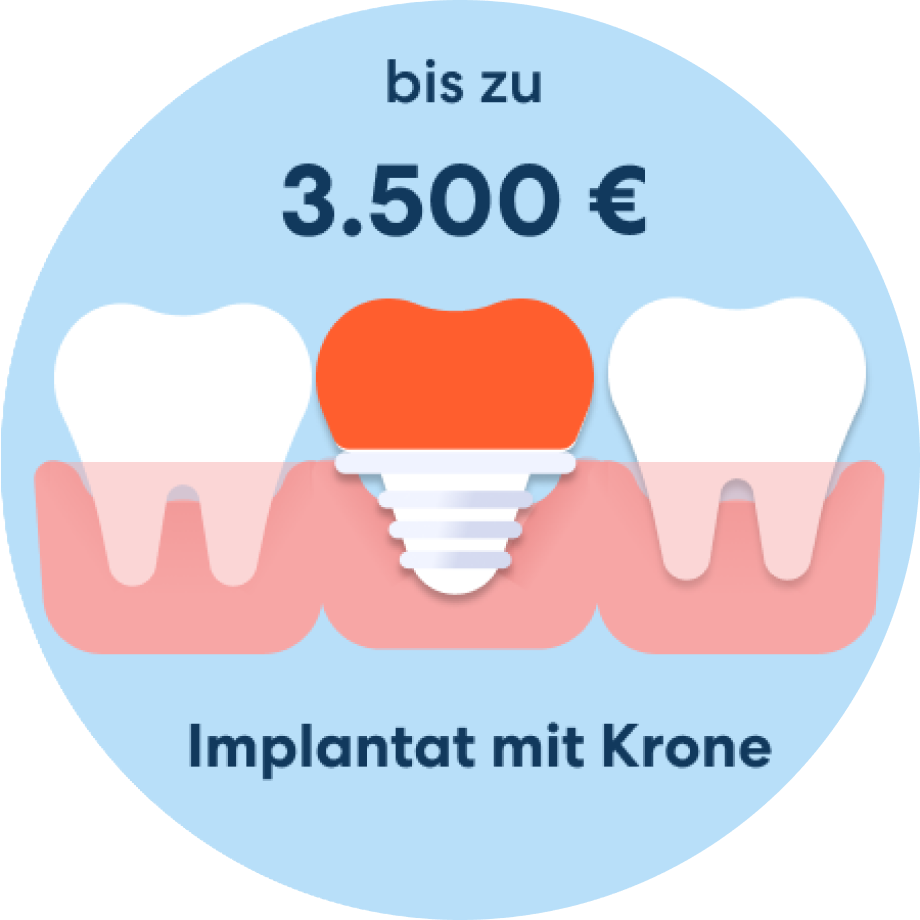 Implantat mit Krone Kosten