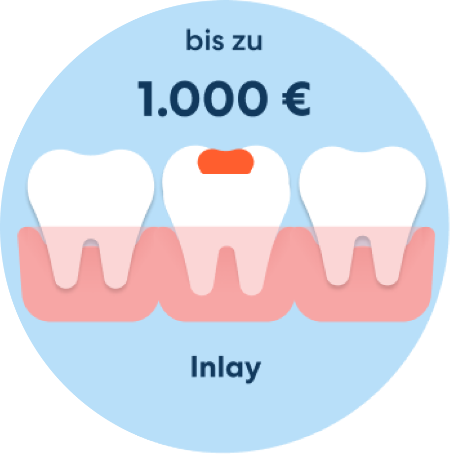 Inlay Kosten