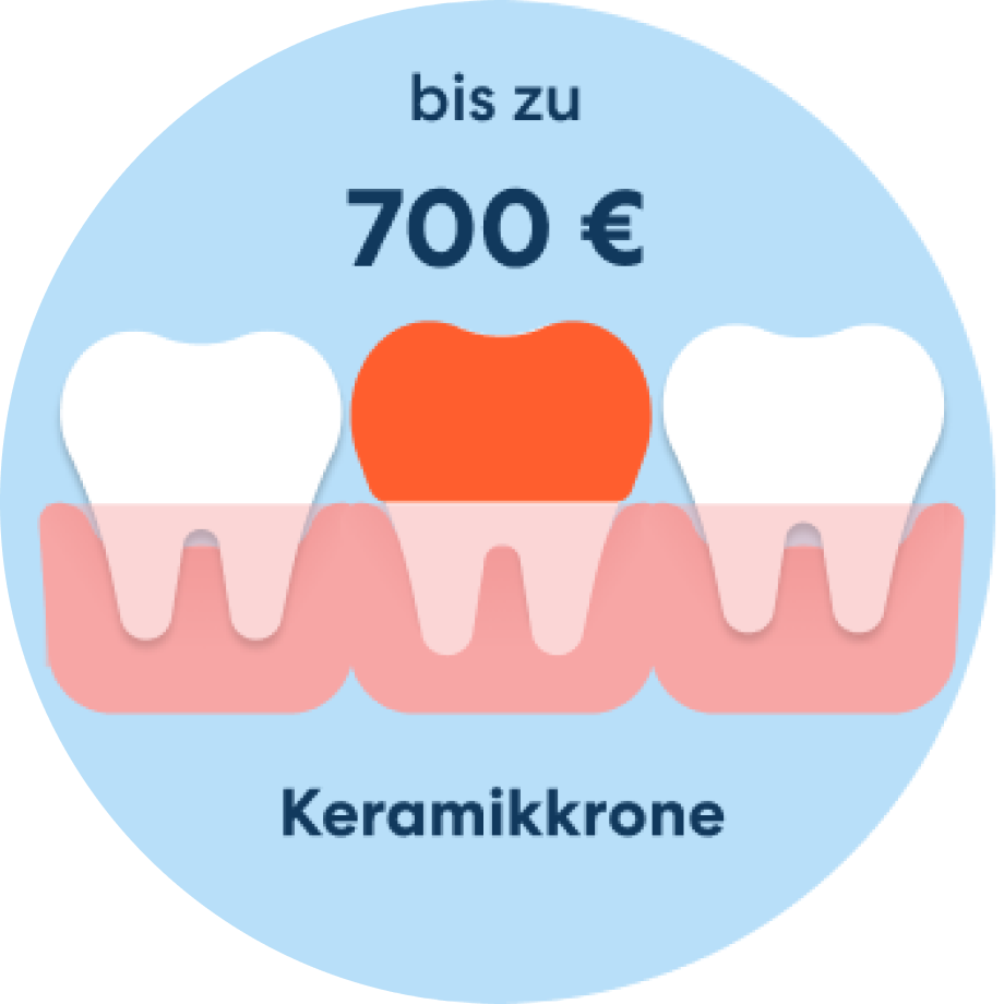 Kosten Krone Zahnzusatzversicherung