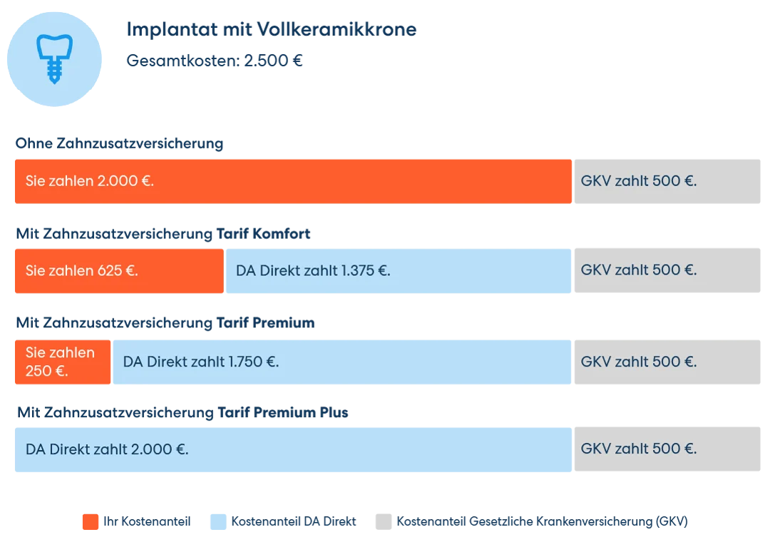 Vergleichsgrafik für die Übernahme der Kosten für ein Implantat mit Vollkeramikkrone. Von 2000 € Eigenbeteiligung ohne Zusatzversicherung bis zur vollen Kostenübernahme im Premium Plus Tarif