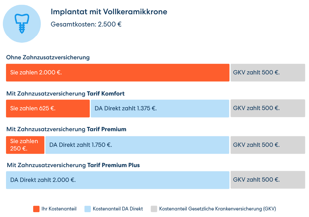 Vergleichsgrafik für die Übernahme der Kosten für ein Implantat mit Vollkeramikkrone. Von 2000 € Eigenbeteiligung ohne Zusatzversicherung bis zur vollen Kostenübernahme im Premium Plus Tarif