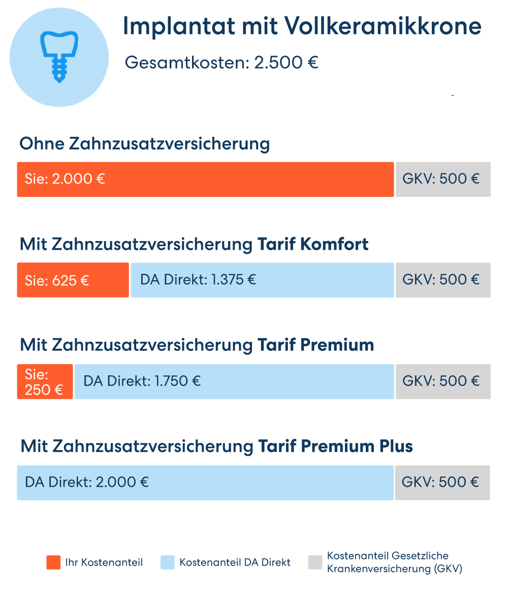 Vergleichsgrafik für die Übernahme der Kosten für ein Implantat mit Vollkeramikkrone. Von 2000 € Eigenbeteiligung ohne Zusatzversicherung bis zur vollen Kostenübernahme im Premium Plus Tarif
