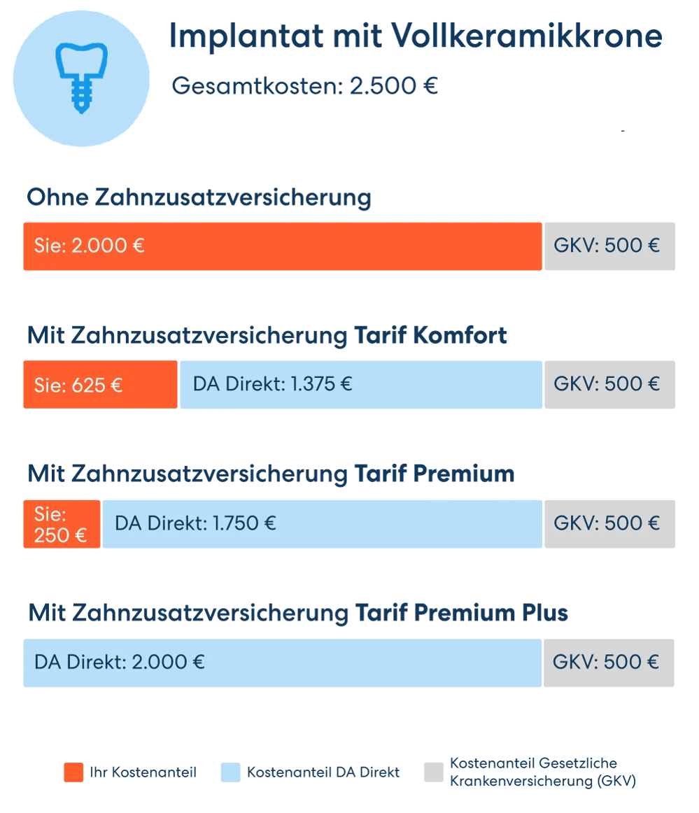 Vergleichsgrafik für die Übernahme der Kosten für ein Implantat mit Vollkeramikkrone. Von 2000 € Eigenbeteiligung ohne Zusatzversicherung bis zur vollen Kostenübernahme im Premium Plus Tarif