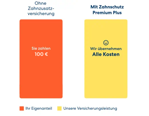 Vergleichsgrafik der Kosten für eine PZR ohne und mit Zahnzusatzversicherung